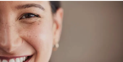 Smile laser eye surgery