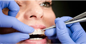 dental braces Adelaide